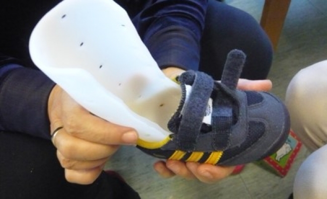 Curso-Taller de Adaptaciones con Material Termoplástico (splints de pie-tobillo)